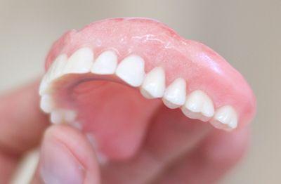 Upper dentures