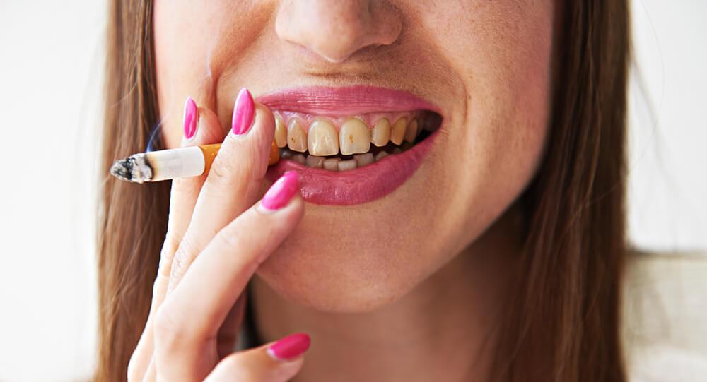 Smoking and Dental Health Problems